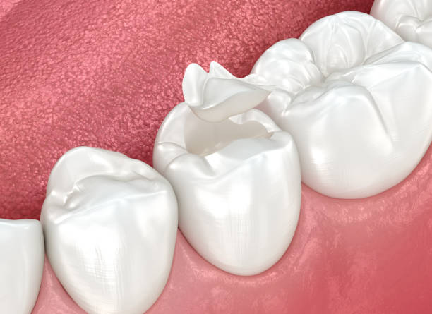 Our Range of Dental Services in Lena, IL