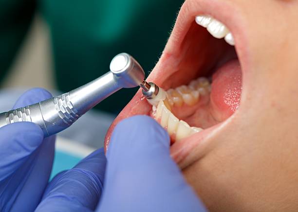 Oral Surgery in Lena, IL